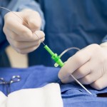 Surgeon Inserting Tube Into Patient During Surgery